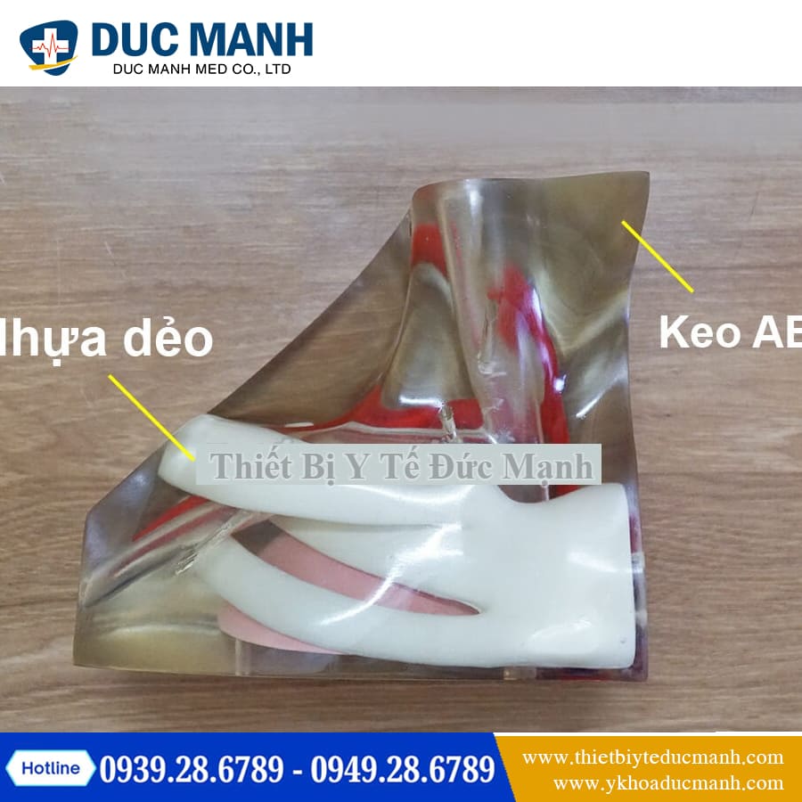 Mo hinh thuc hanh dat Catheter tinh mach3