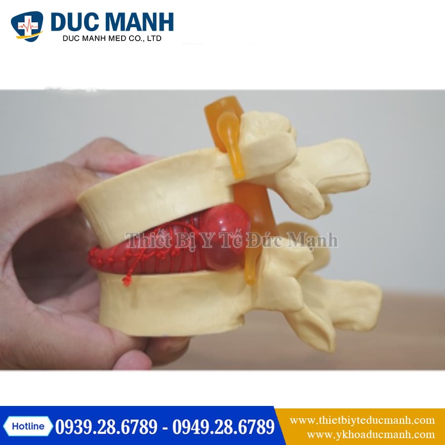 Mo hinh thoat vi dia dem