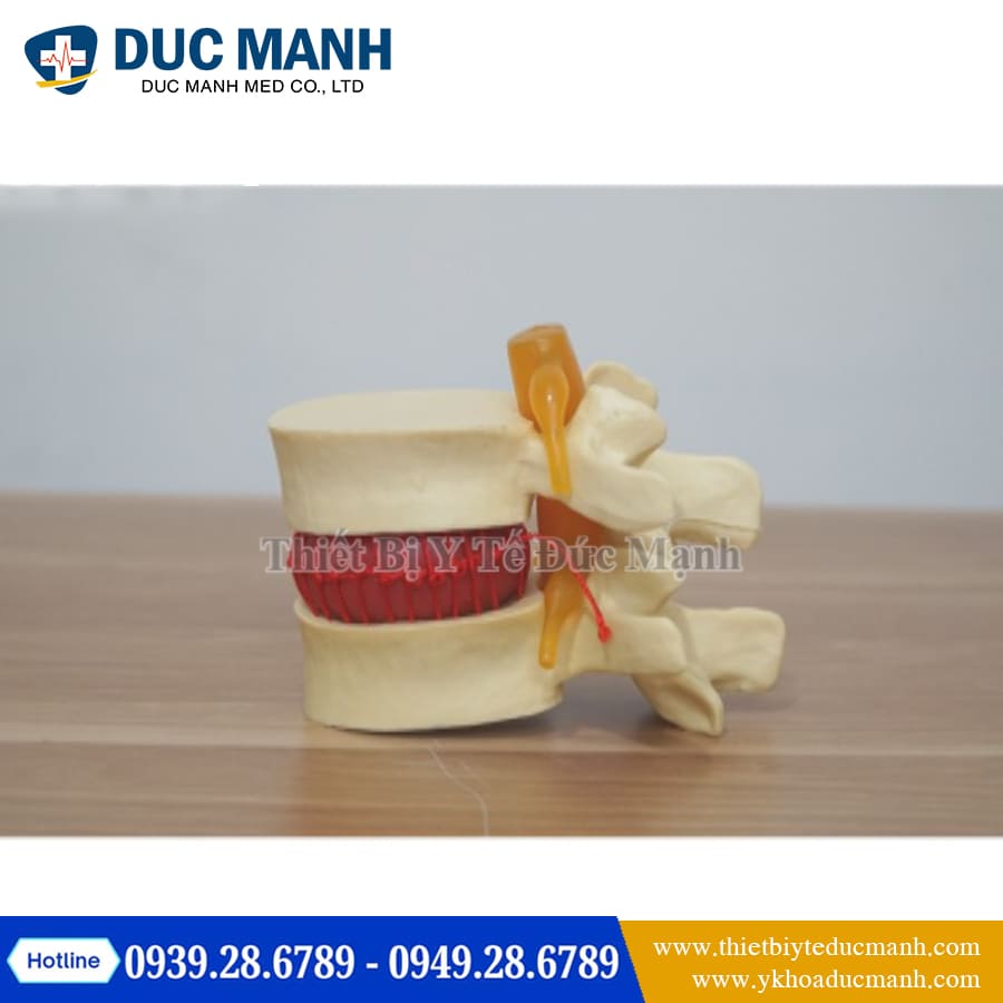 Mo hinh thoat vi dia dem1