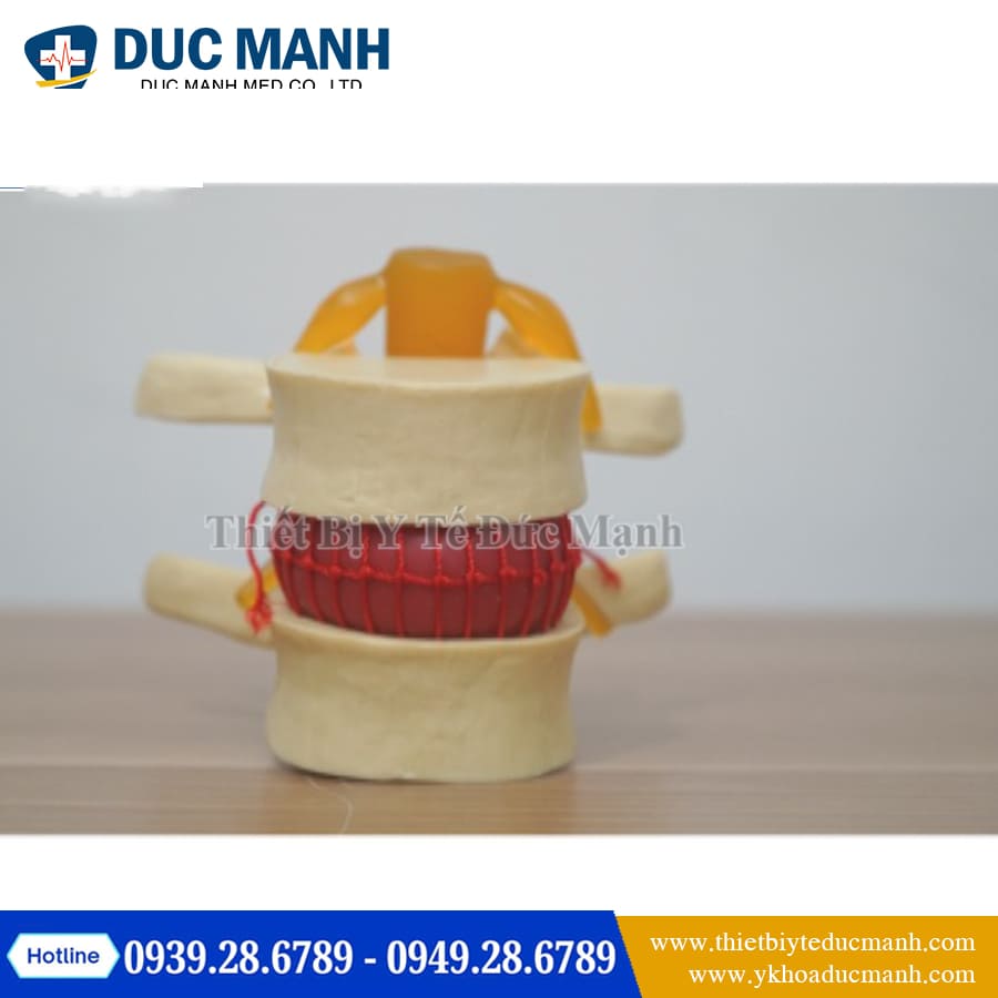 Mo hinh thoat vi dia dem2