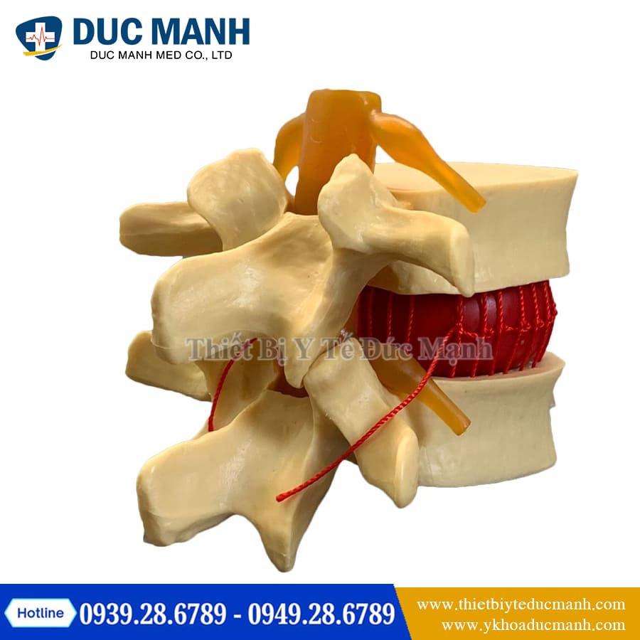 Mo hinh thoat vi dia dem3