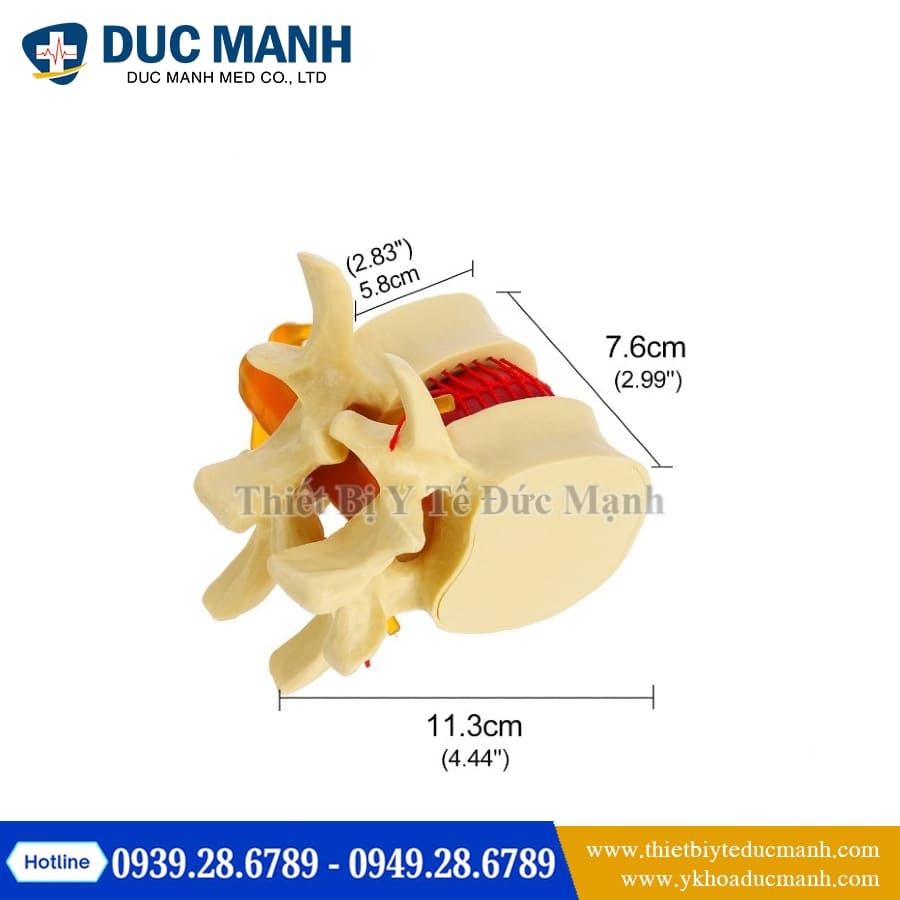 Mo hinh thoat vi dia dem4