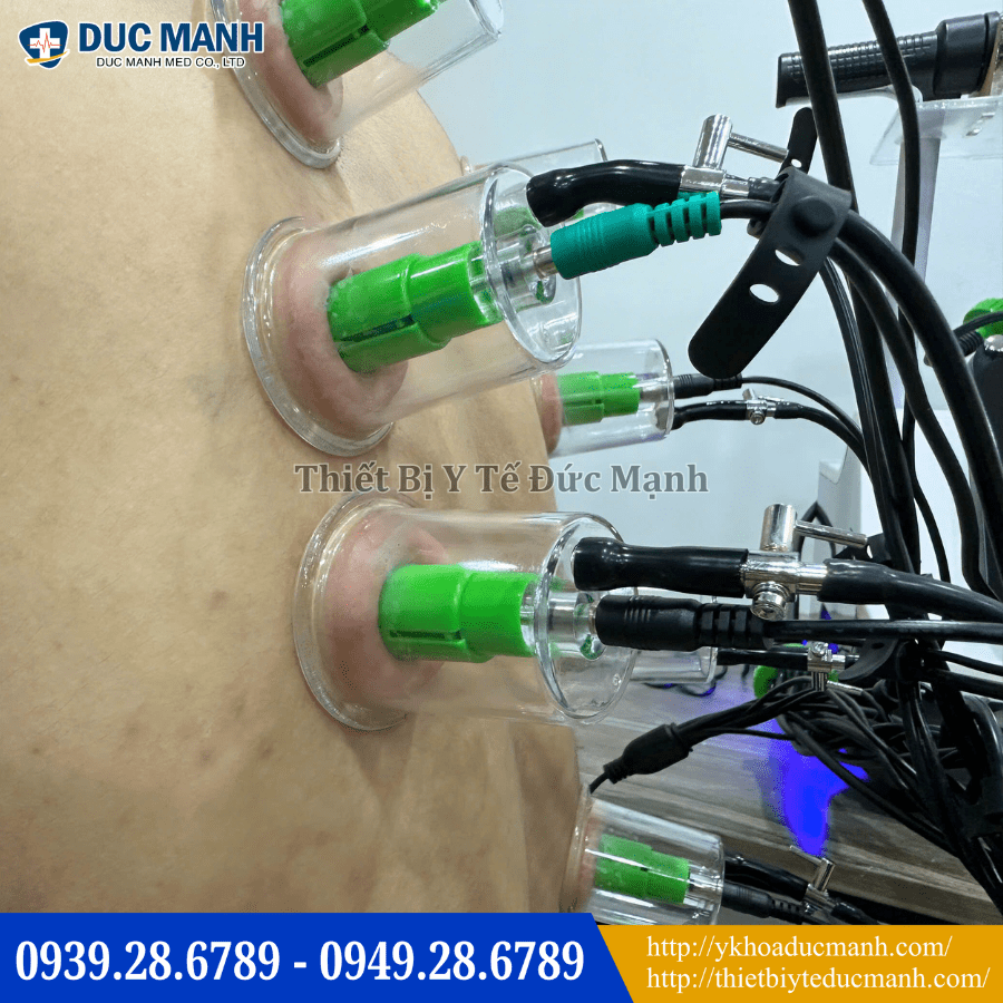 may dien cham khong kim 6 1