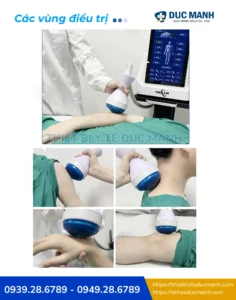 máy xung kích hội tụ Texua R23