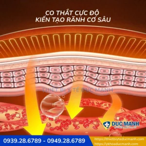 Máy tăng cơ giảm mỡ công nghệ HIFEM