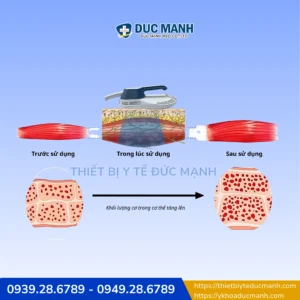 Máy tăng cơ giảm mỡ công nghệ HIFEM