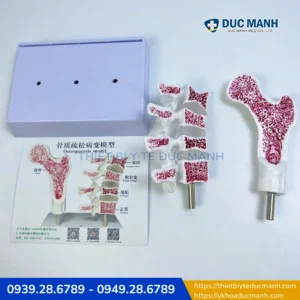 Mô hình bệnh lý loãng xương