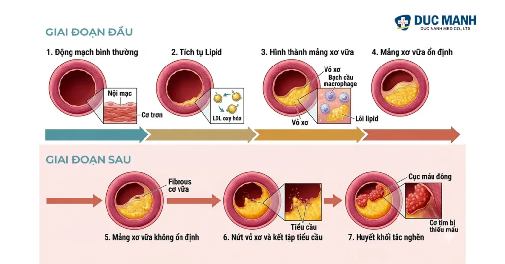 dau hieu tac nghen mach mau trieu chung