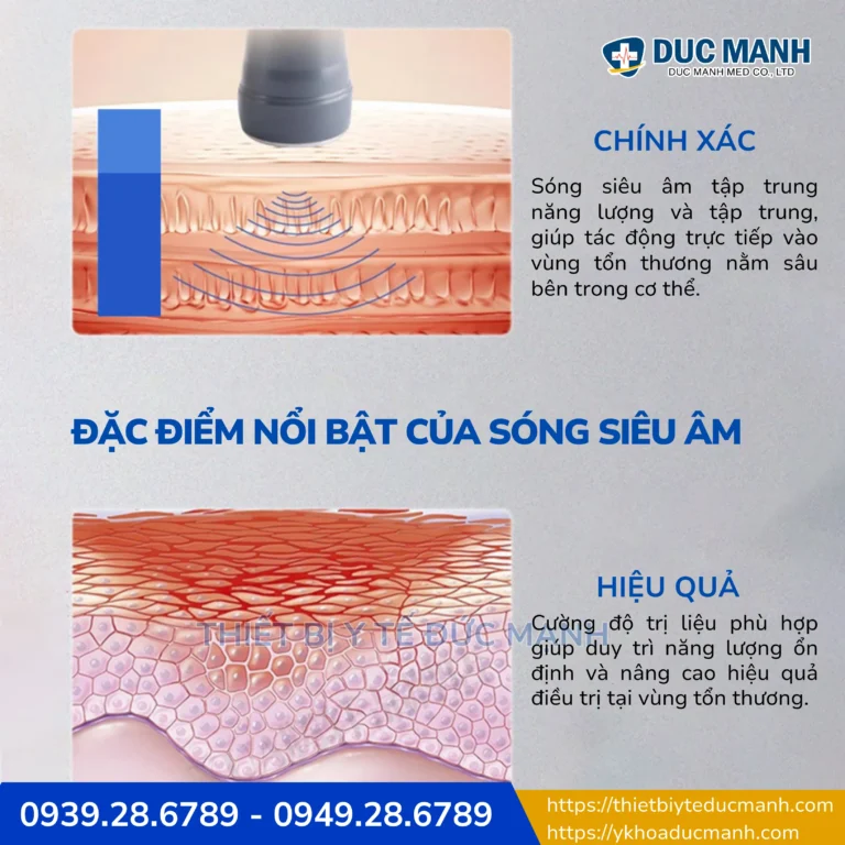 review cac dong may sieu am tri lieu 2