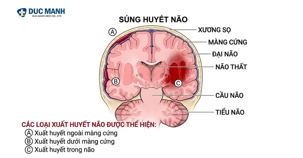xuat huyet nao co nguye hiem khong 1 1