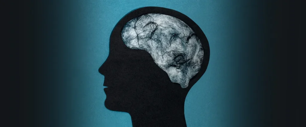 Xuất huyết não có nguy hiểm không? : Nguyên nhân, dấu hiệu và biến chứng