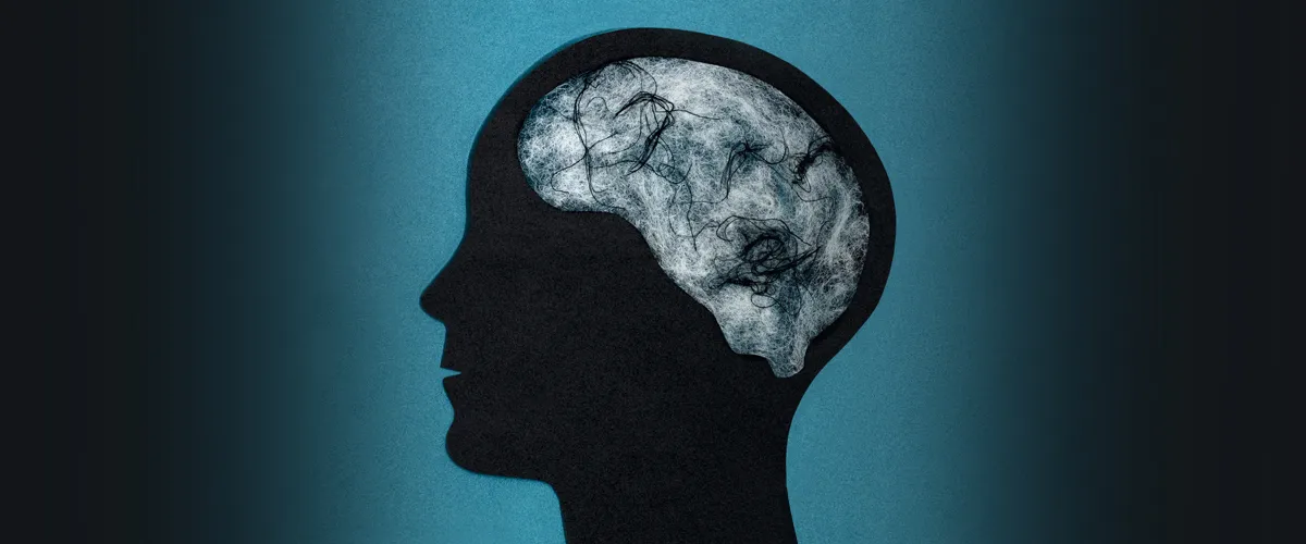 Xuất huyết não có nguy hiểm không? : Nguyên nhân, dấu hiệu và biến chứng