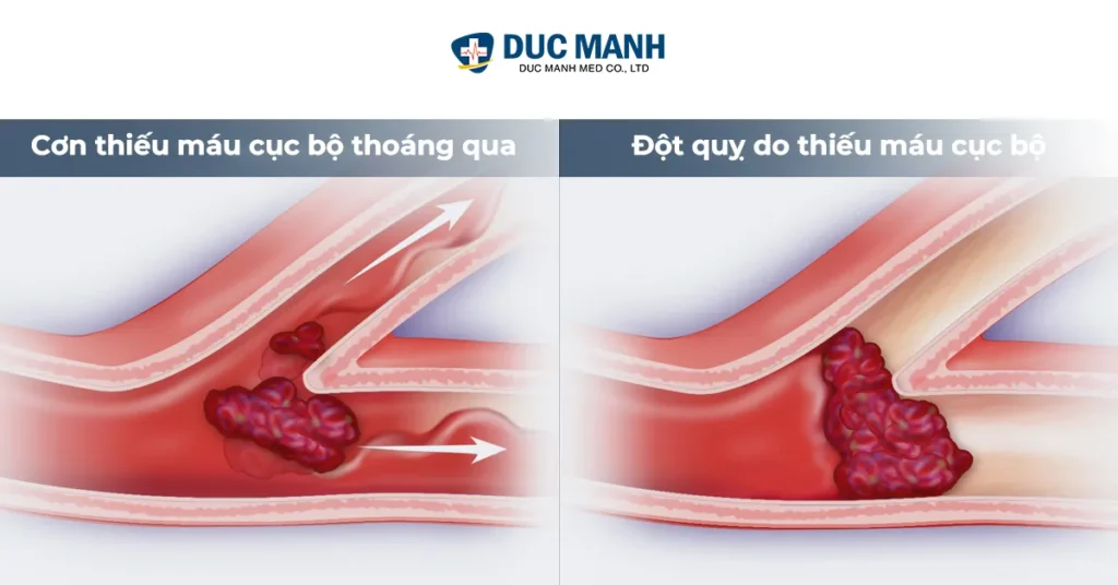 xuat huyet nao co nguye hiem khong 2